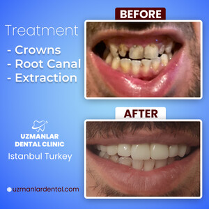 Image of Uzmanlar Dental Clinic Gallery 6