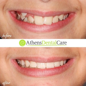 Image of Athens Dental Care Gallery 0