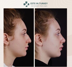 Image of Este in Turkey Gallery 2