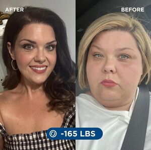 Image of Weight loss surgery