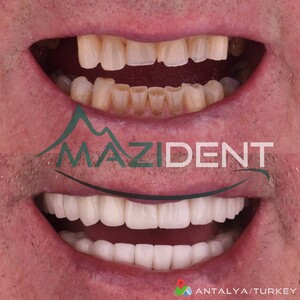 Image of Mazıdent Oral and Dental Health Clinic Gallery 3