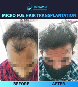 Image of DermaVue Skin, Cosmetology & Hair Transplant Gallery 1