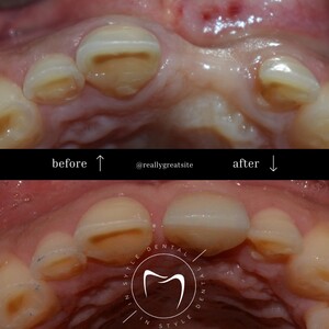 Image of Before and after treatment