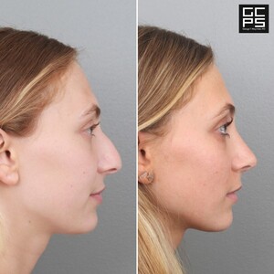 Image of Gold Coast Plastic Surgery- Dr. George T. Moynihan Gallery 1