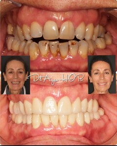 Image of Antalya Ortodonti Oral and Dental Health Polyclinic Gallery 3