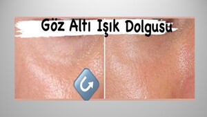 Image of Dr.Ebru Karagün - EZ Derm Gallery 0