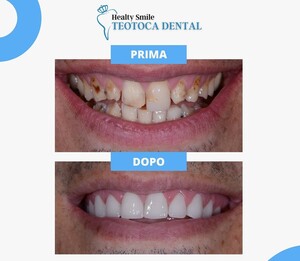 Image of Cosmetic dentistry before and after