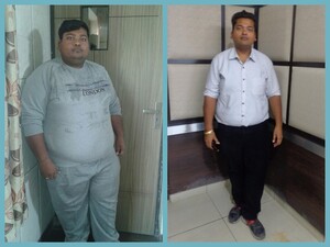 Image of  After 9 months of Mini Gastric Bypass