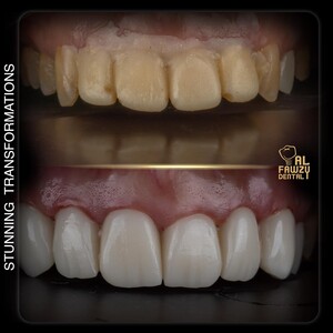 Image of Al Fawzy Dental Gallery 1