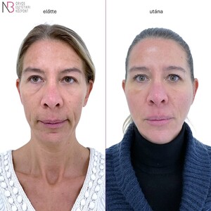 Image of Aesthetic operation - New Beauty Medical Aesthetic Center