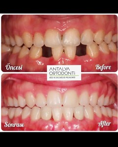 Image of Antalya Ortodonti Oral and Dental Health Polyclinic Gallery 0