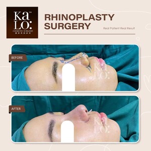 Image of KALO Cosmetic Surgery Gallery 3