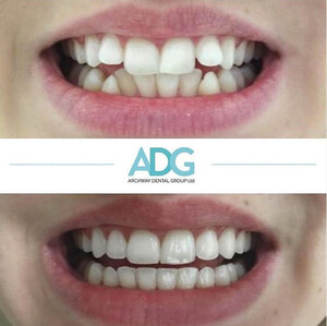 Image of Archway Dental Group Gallery 0