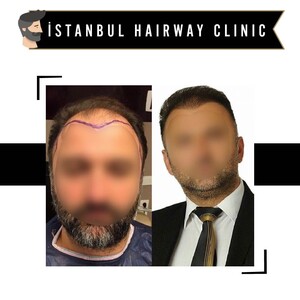 Image of İstanbul Hairway Clinic Gallery 3