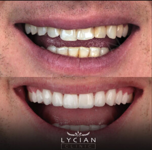 Image of Lycian Dental Clinic Gallery 0