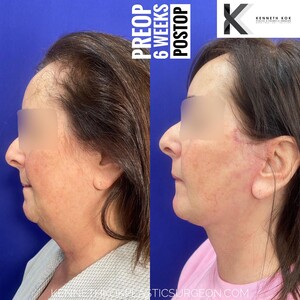 Image of Kenneth Kok Plastic Surgery Clinic Gallery 1