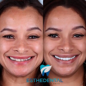 Image of Esthedental Gallery 2