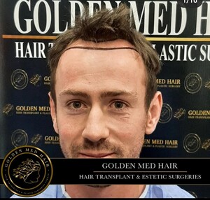 Image of Golden Med Hair Gallery 3