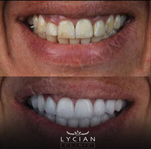 Image of Lycian Dental Clinic Gallery 1