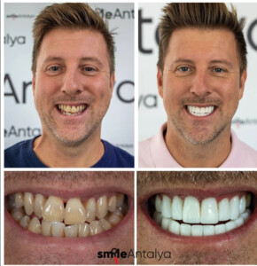 Image of Smile Antalya Dental Gallery 2