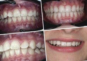 Image of Perfect Dental Care Gallery 1