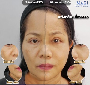 Image of MAXi Cosmetic Surgery Gallery 1