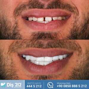 Image of Diş 212 - Dental Aesthetic Facility Gallery 2