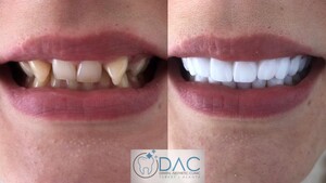 Image of DAC - Alanya Dental Aesthetic Clinic Gallery 1