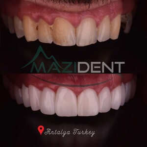 Image of Mazıdent Oral and Dental Health Clinic Gallery 2