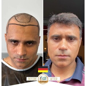 Image of Life Time Esthetic & Hair Transplant Gallery 1