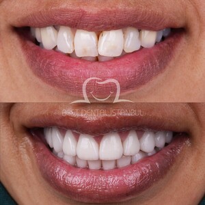 Image of Best Dental Istanbul Gallery 0