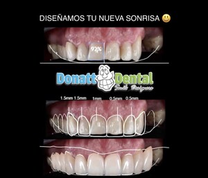 Image of Smile design