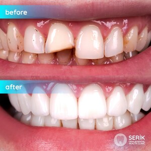 Image of Private Serik Oral and Dental Health Policlinic Gallery 0