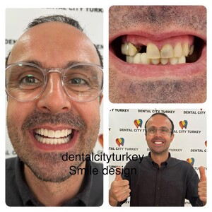 Image of Dental City Turkey Gallery 3