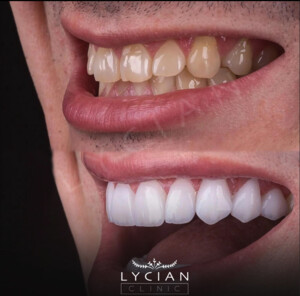 Image of Lycian Dental Clinic Gallery 2