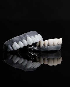 Image of Dentures