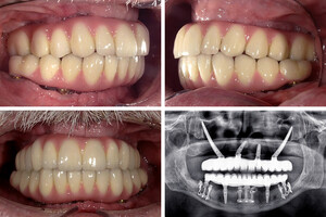 Image of Ortoimplant Dent Spa Gallery 2