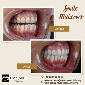 Image of Dr. Smile Antalya Gallery 1