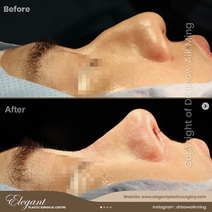 Image of Elegant Plastic Surgical Centre Gallery 0