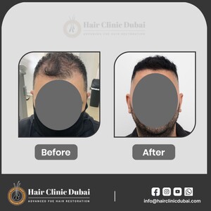 Image of The Hair Clinic Dubai Gallery 0