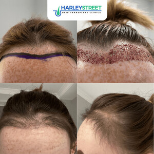 Image of Harley Street Hair Transplant Clinics Gallery 1