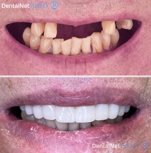 Image of Dental Net Turkey Gallery 3