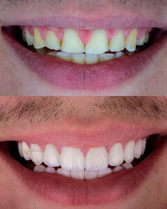 Image of Smile makeover