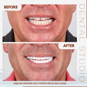 Image of Smile makeover