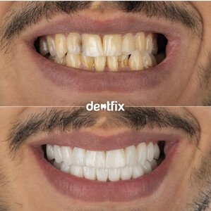 Image of Dentfix Turkey Gallery 1