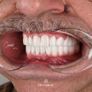 Image of Dentakay Dental Clinic Gallery 0