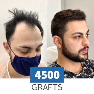 Image of Likya Aesthetic & Hair Transplant Gallery 0