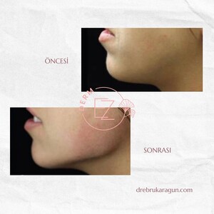 Image of Dr.Ebru Karagün - EZ Derm Gallery 2