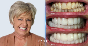 Image of Cadde Dental Gallery 2