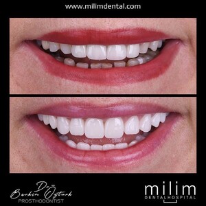 Image of Milim Dental Gallery 0